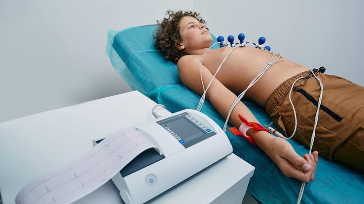 ECG
