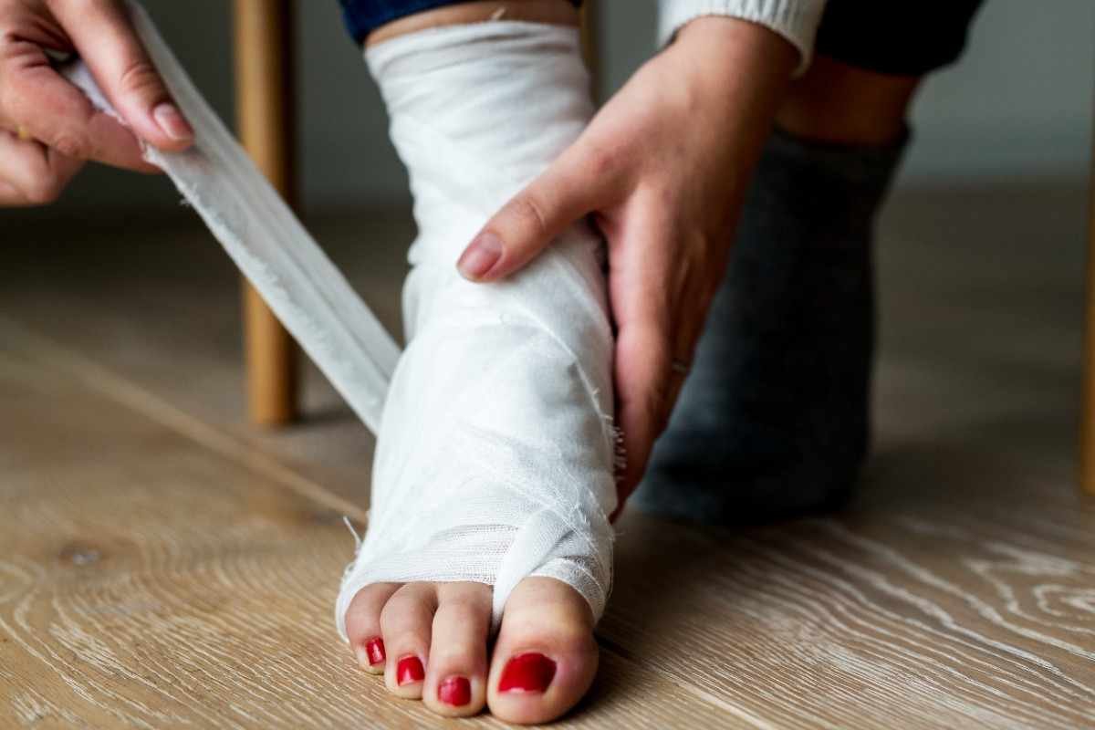 Non-Union and Malunion of Fracture