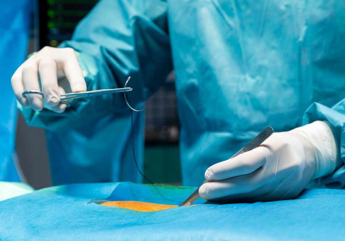 Hand and Microvascular Surgery